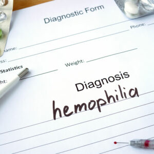 Hemophilia – Its types, symptoms, and management