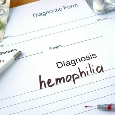 Hemophilia – Its types, symptoms, and management